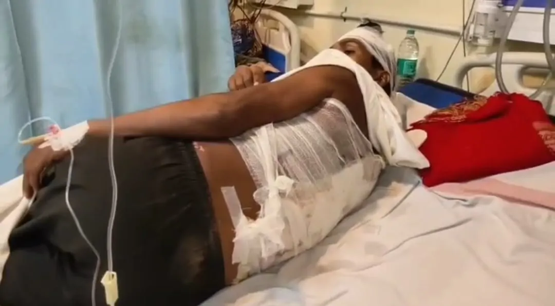 दरभंगा: पुलिस टीम पर ग्रामीणों का हमला, पथराव में वाहन का शीशा टूटा; ASI घायल उपचार जारी